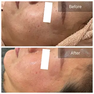 【現役看護師】高来 笑子のエステ・リラクイメージ