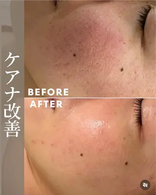 肌育成サロン ♡ RISAのエステ・リラクイメージ