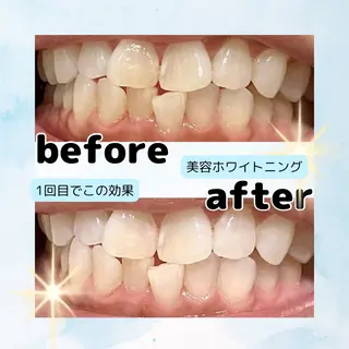 ホワイトニングサロン Soleilのその他イメージ