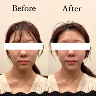 Hari Lounge恵比寿所属・chika🦋 ハリラウンジ恵比寿のエステ・リラクイメージ