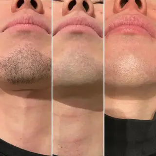 総合エステサロン 肌活のエステ・リラクイメージ