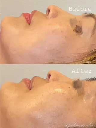 🅖🅤🅩🅔🅛 salonのエステ・リラクイメージ