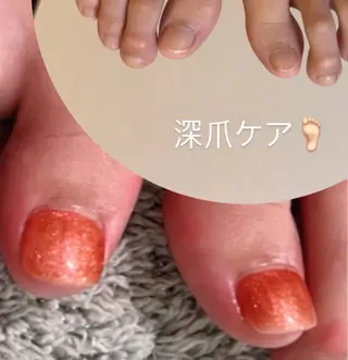 メンズ ネイル 爪ケア/深爪 自爪育成 🐰えむのネイルデザイン