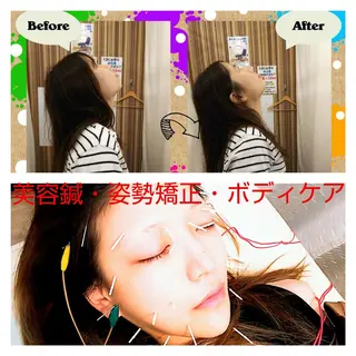 むくみたるみ専門☆ 美容鍼・小顔矯正のエステ・リラクイメージ