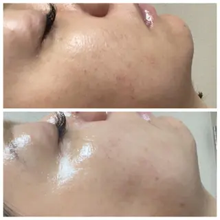 肌質改善サロン facialmoonのエステ・リラクイメージ