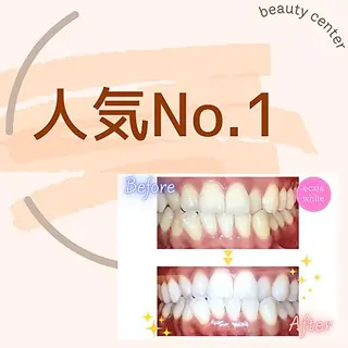 セルフホワイトニング エクシア大阪梅田店のその他イメージ