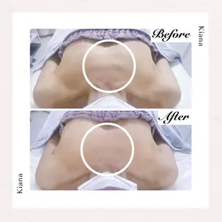 バスト専門Kiana 風のエステ・リラクイメージ