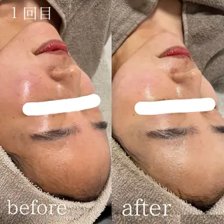 Beauty SalonReeleのエステ・リラクイメージ