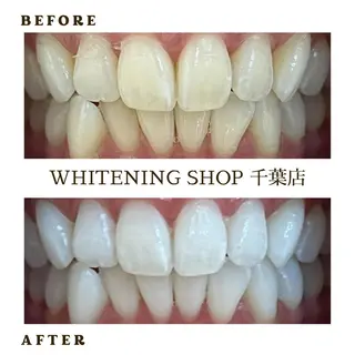メンズ ホワイトニング ショップ千葉店のその他イメージ