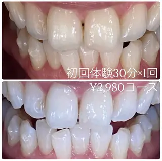 PLATINUM Beauty 横浜店所属・ホワイトニングルーム 横浜店のその他イメージ