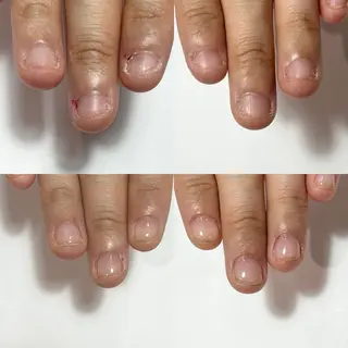 自爪育成・巻き爪 補正講師　津蔵のネイルデザイン