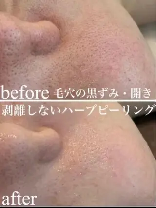 Belle栄店所属・韓国肌管理 Belle栄店のエステ・リラクイメージ