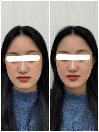 美容鍼×小顔矯正 ×美容整体　浜川泰仁のエステ・リラクイメージ