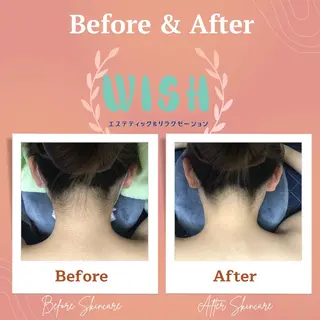 WISH 美肌脱毛のプロ！須藤のエステ・リラクイメージ