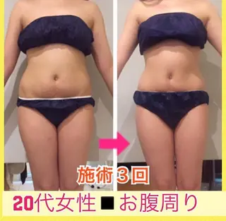 ロング カラー パーマ ヘアアレンジ メンズ キッズ ネイル マツエク・マツパ ‍痩身＆ボディ 結果出し🌟丹野のエステ・リラクイメージ