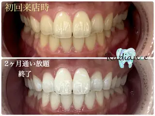 札幌ホワイトニング ラディアンス菊水店のその他イメージ