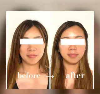 小顔セラピーLIL所属・小顔セラピー LILのエステ・リラクイメージ