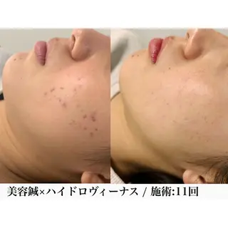 堀之内宏次 ［美容鍼灸師］のエステ・リラクイメージ