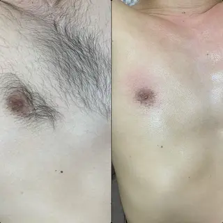 六本木脱毛andS さおりのエステ・リラクイメージ