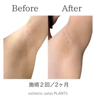 メンズ esthetic salon PLANTS所属・エステティックサロン PLANTSのエステ・リラクイメージ