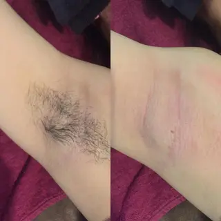 MIX脱毛 リュミエールアンジュのエステ・リラクイメージ