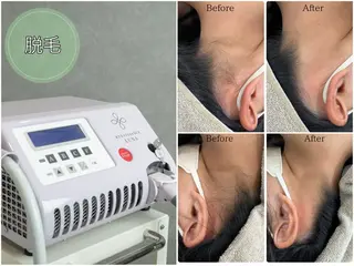 LiLL by Andre beauty所属・LiLL 熊本のエステ・リラクイメージ