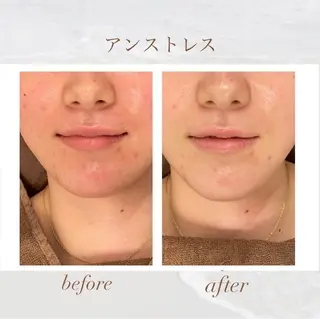 🦋美肌サロン. maho🦋のエステ・リラクイメージ