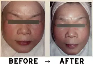 VICTOIRE MARUYAMAのエステ・リラクイメージ