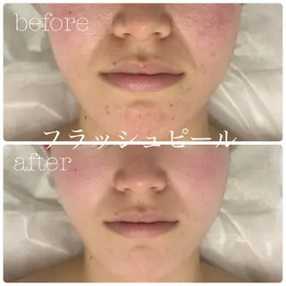 フェイシャルサロン CHIARA 荒田のエステ・リラクイメージ