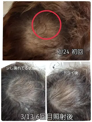 五十嵐 蓮のその他イメージ