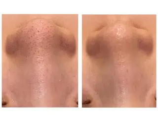 レイビス名古屋♡ 伊波のエステ・リラクイメージ