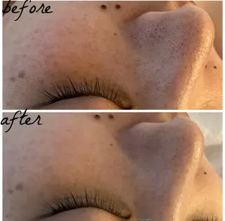 メンズ メナード岐阜市茜部 杉浦のエステ・リラクイメージ