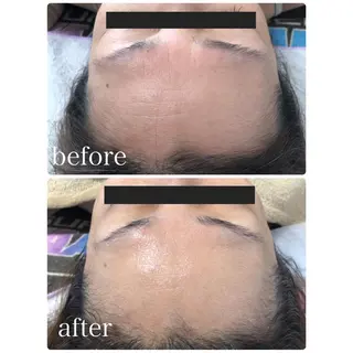 体の中から肌質改善 クレール 奈良のエステ・リラクイメージ