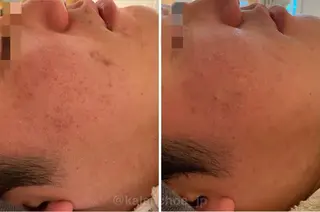 肌質改善 KALANCHOEのエステ・リラクイメージ