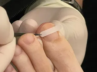 日本巻き爪センター渋谷院所属・日本巻き爪センター 渋谷院のエステ・リラクイメージ