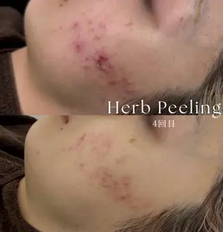 Belle原宿所属・佐藤 加奈のエステ・リラクイメージ