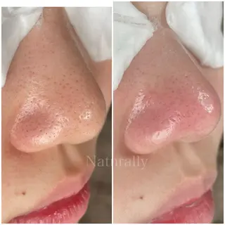 Naturally ナチュラリーのマツエク・マツパデザイン