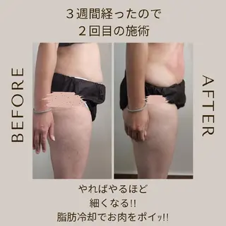 脂肪冷却・脱毛サロン coconoix のエステ・リラクイメージ