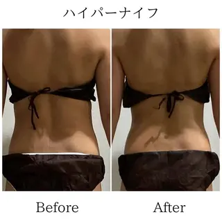 LiLL by Andre beauty所属・LiLL 熊本のエステ・リラクイメージ