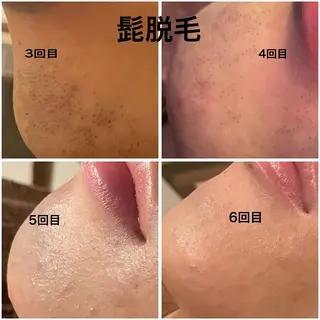 メンズ espoir-K 横浜のエステ・リラクイメージ