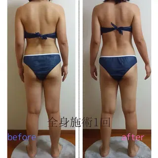 ACORAL痩身 NAZUKIのエステ・リラクイメージ