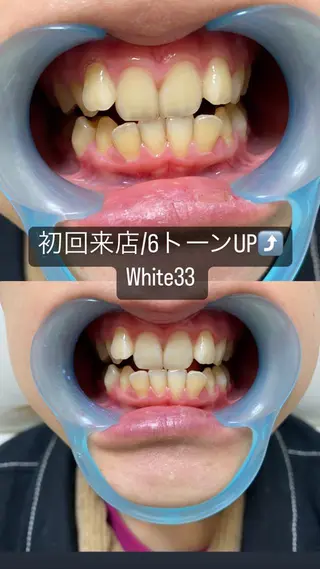 メンズ セルフホワイトニング White33大名のその他イメージ