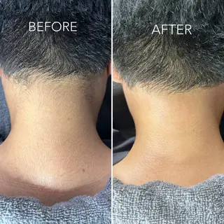 メンズ TREE WAX脱毛のエステ・リラクイメージ