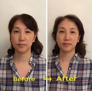 町田・鶴川 小顔矯正 /鈴木友実のその他イメージ