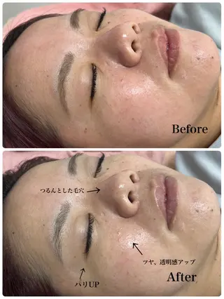 Astorie 相模大野エステのその他イメージ