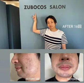 メンズ パーソナルカウンセラー付き:メンズセルフ脱毛・セルフホワイトニング専門店 ズボコスサロン笹塚所属・パーソナルセルフ脱毛 ズボコスサロンのエステ・リラクイメージ