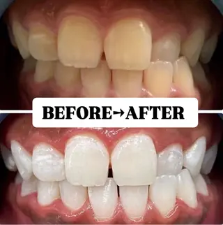 メンズ キッズ 歯科提携サロン ホワイトニング豊中のその他イメージ