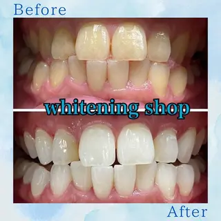 ホワイトニング ショップ葛西店のその他イメージ