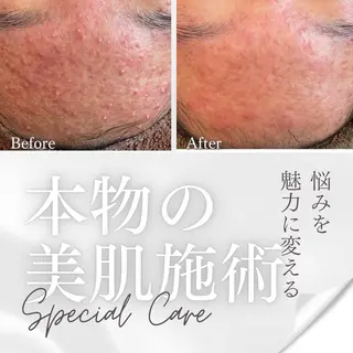 💚THE BALM 金子💚✨のエステ・リラクイメージ