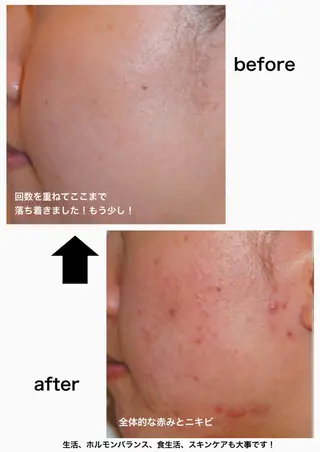 M. lisyelのエステ・リラクイメージ